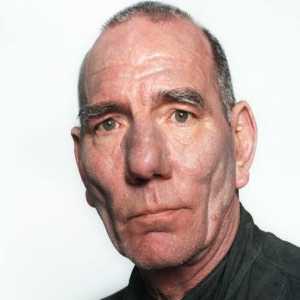 Pete Postlethwaite
